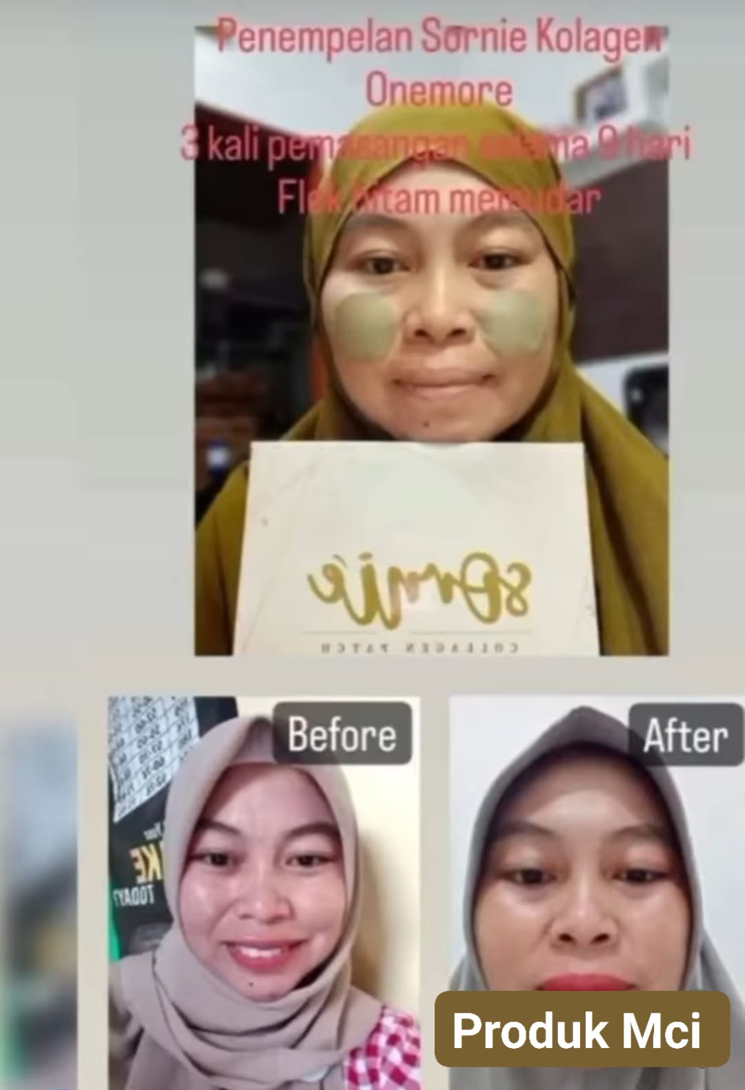 Testimoni Sornie Collagen Patch (3)